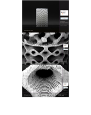 Knorpel-Knochenersatz durch 3D-Druck mit höchster Auflösung in kürzester Zeit