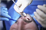 Neuer Ansatz gegen Parodontitis
