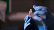 Roboterfinger aus dem 3D-Drucker entwickelt
