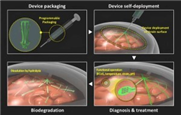Hightech-Hirnsensor ist biologisch abbaubar