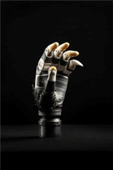 Neue Hightech-Handprothese greift intuitiv zu