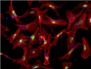 Neues 3D-Material lässt Gehirnzellen kommunizieren
