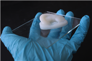 Das Implantat löst sich im Körper auf